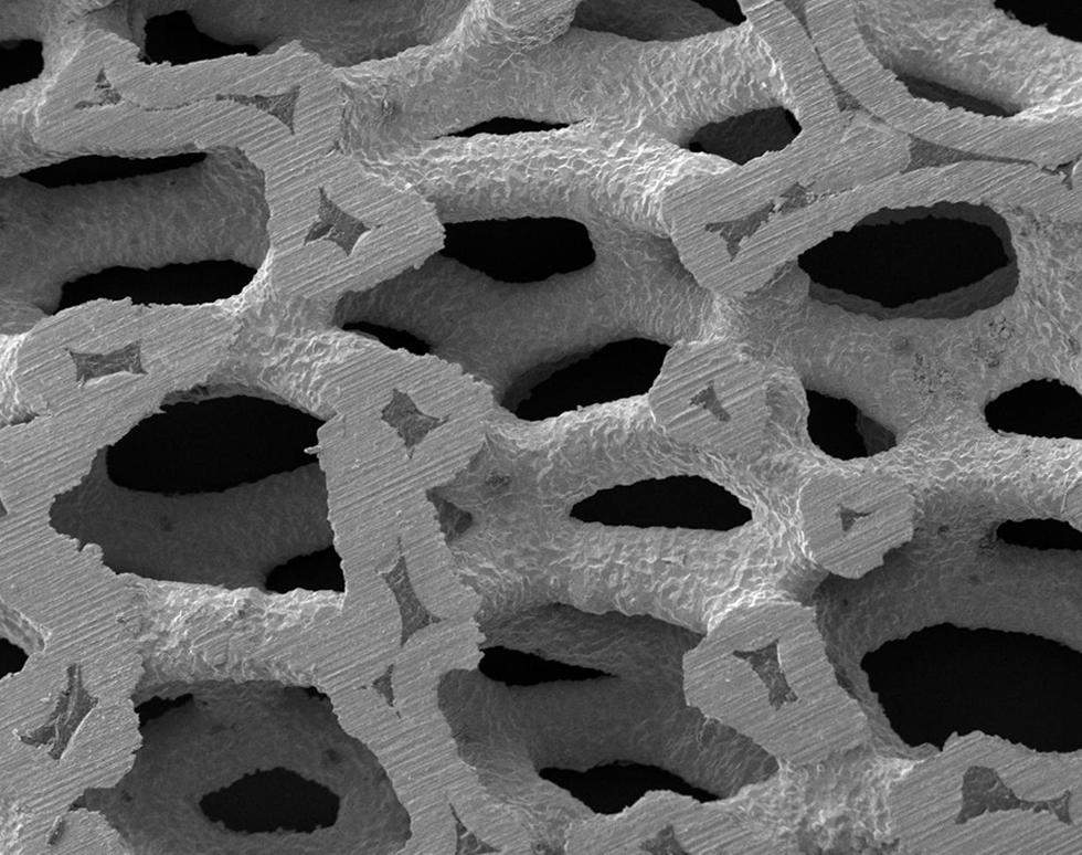 Trabeculation - James Smith